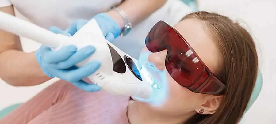 Teeth-Whitenin-3