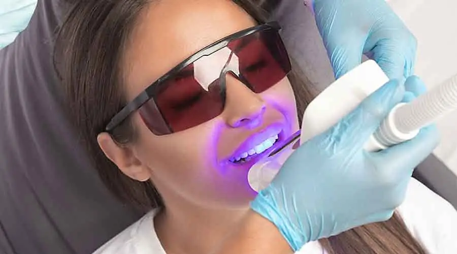 Teeth-Whitening