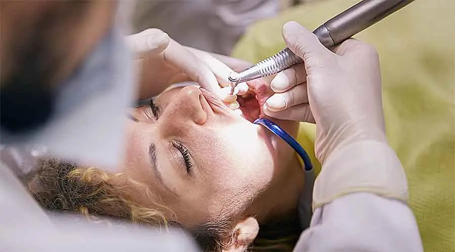 Teeth-Cleaning-2