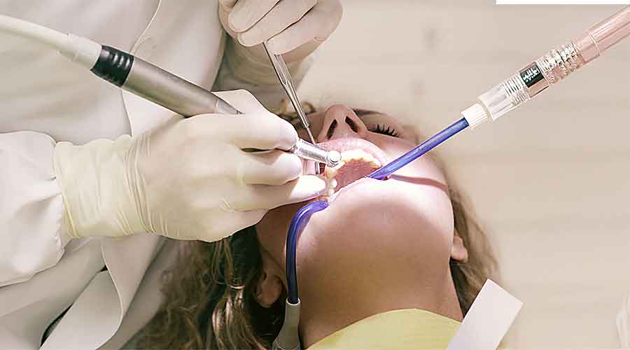 Teeth-Cleaning-3